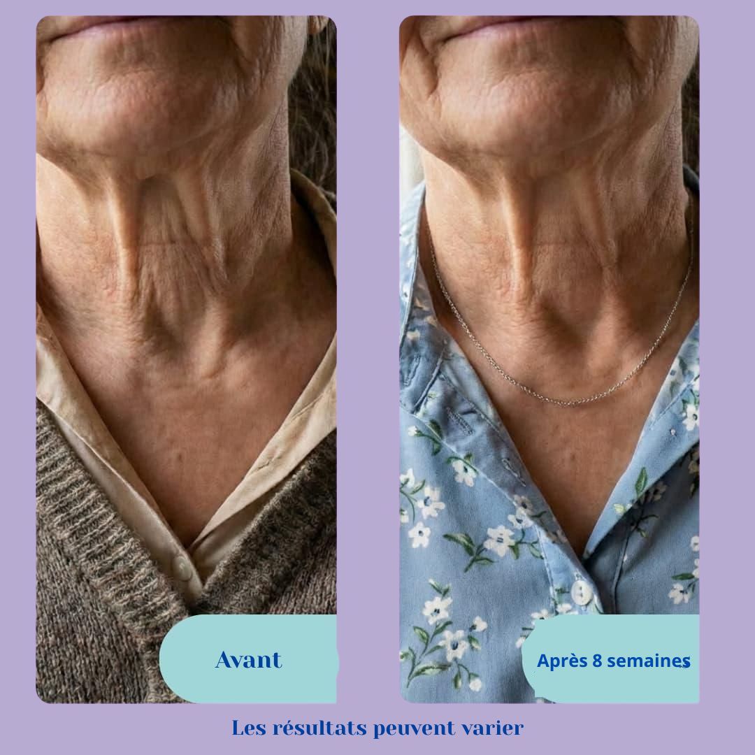 Crème Anti-Rides du Cou