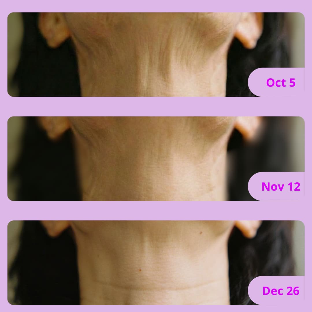 Crème Anti-Rides du Cou